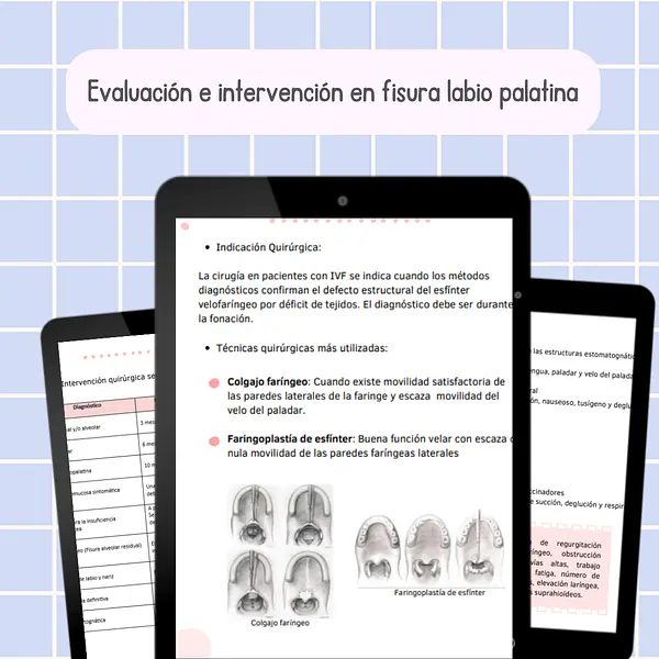 Apuntes: Evaluación e intervención en fisura labio palatina
