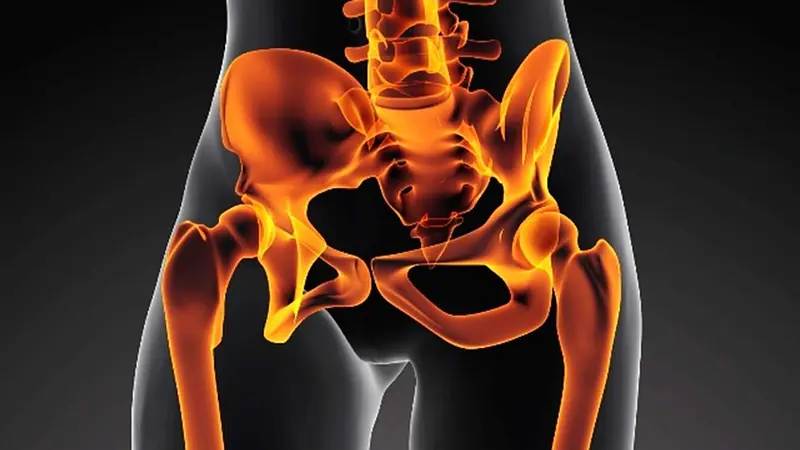 ¿Te han diagnosticado una pierna mas corta que la otra?